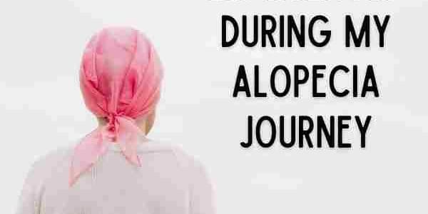 7 Things I Have Experienced During My Alopecia Journey
