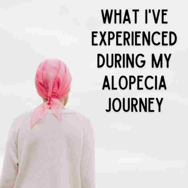 7 Things I Have Experienced During My Alopecia Journey